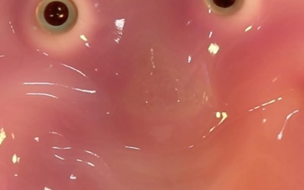 Científicos usan piel viva para crear un robot que sonríe